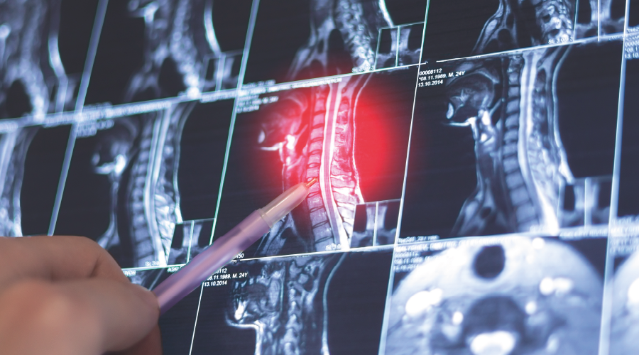 Çocuklarda "metin boyun sendromu"