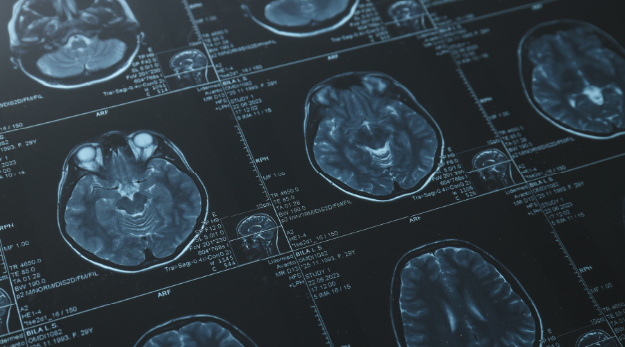 Böbrek ve sinir doku hücreleri anıları depolayabiliyor