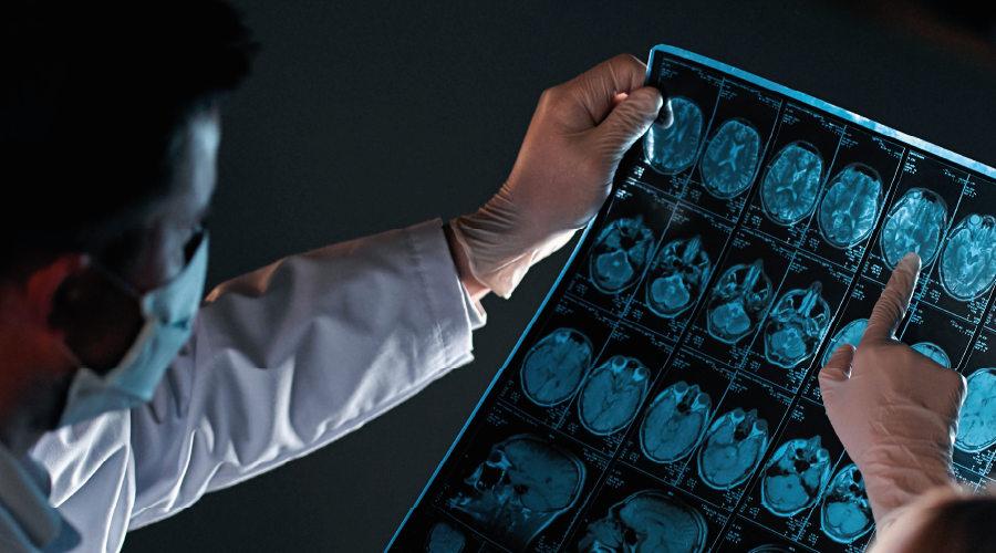 Kalpte "Mini Beyin" keşfedildi