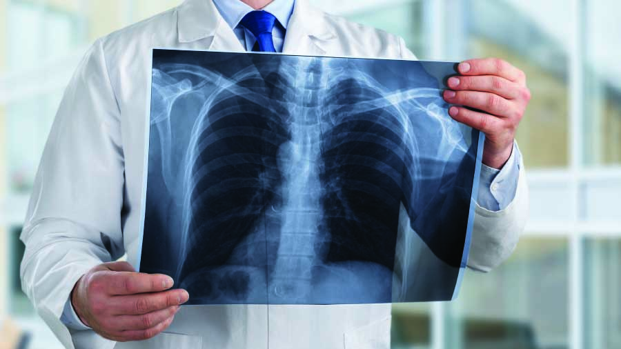 Çevre faktörleri astıma neden oluyor